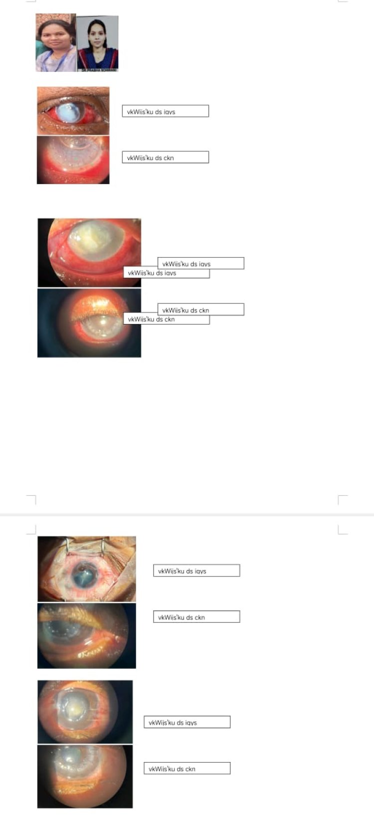 नेत्रदान से मिली रोशनी सिम्स में हुआ कॉर्निया  प्रत्यारोपण का सफल ऑपरेशन 